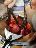 Abdominal 14